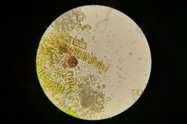 algae-under-the-microscope-2025-02-02-11-48-04-utc.jpg algae-under-the-microscope-2025-02-02-11-48-04-utc.jpg